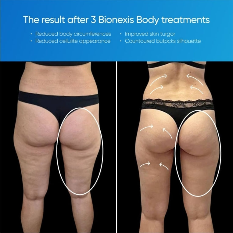 Zemits Bionexis Lite Pro Konturierungssystem