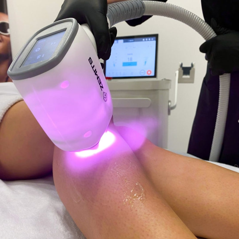 Zemits Quidion Diodenlaser zur Haarentfernung