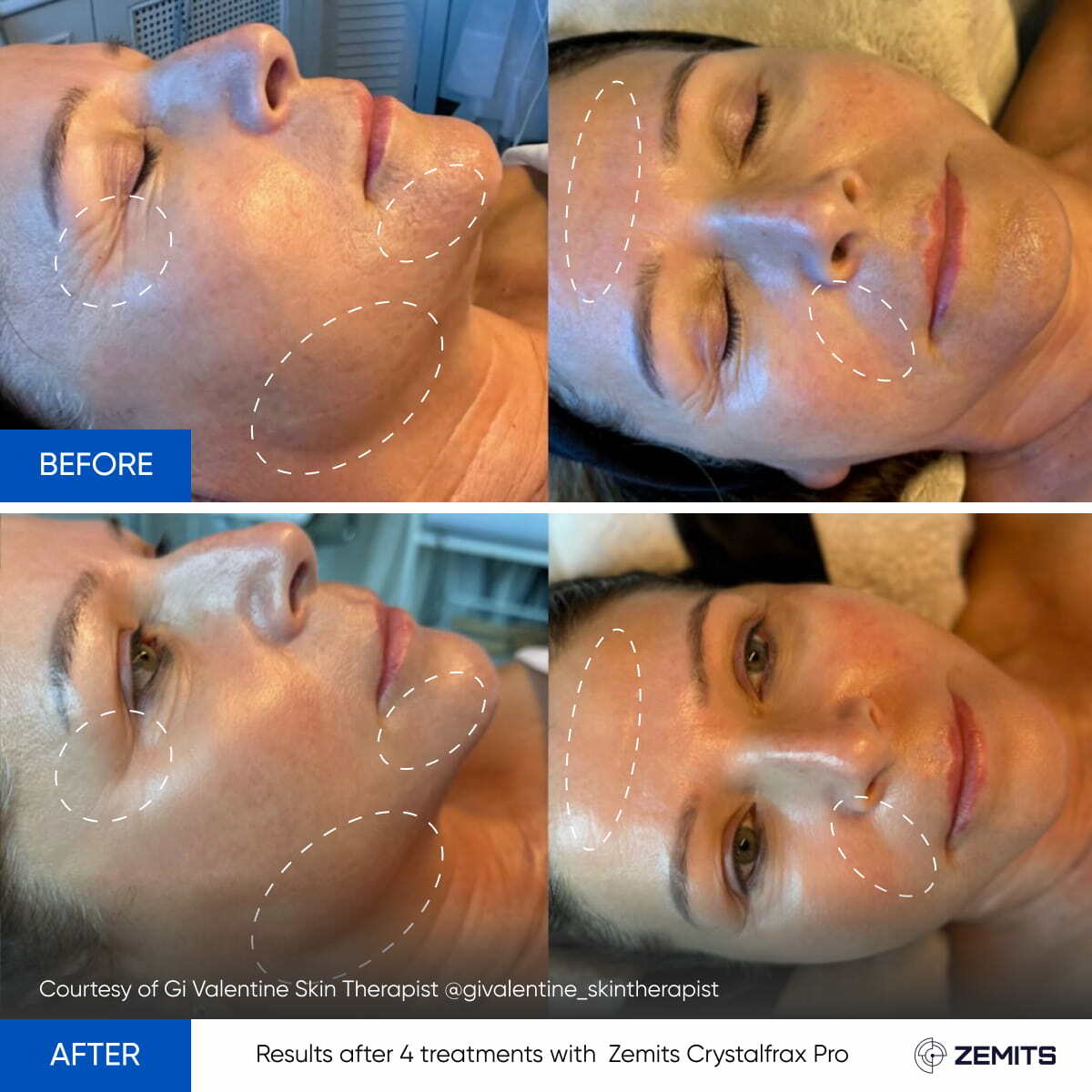 Before After Slide 7
