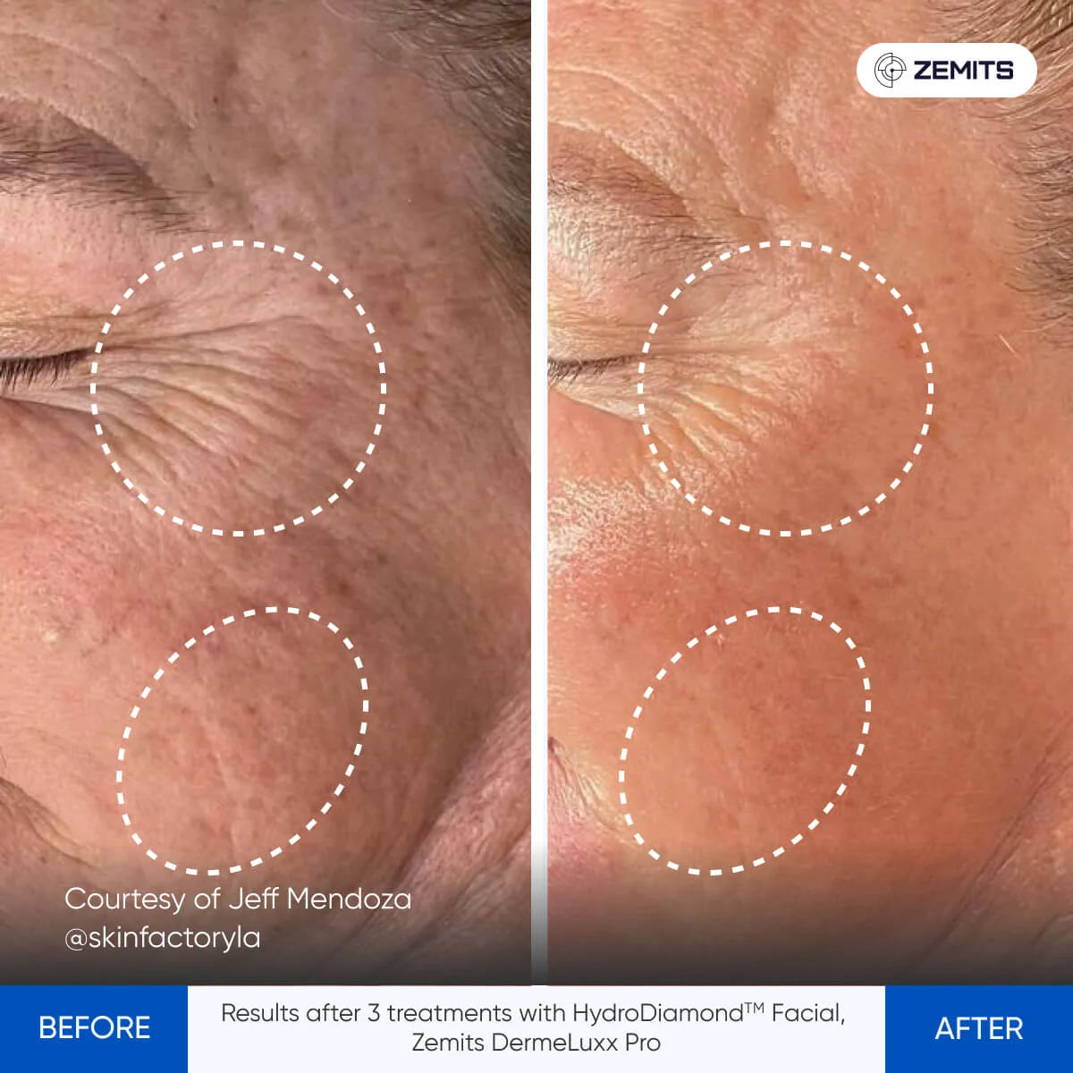Before After Slide 4