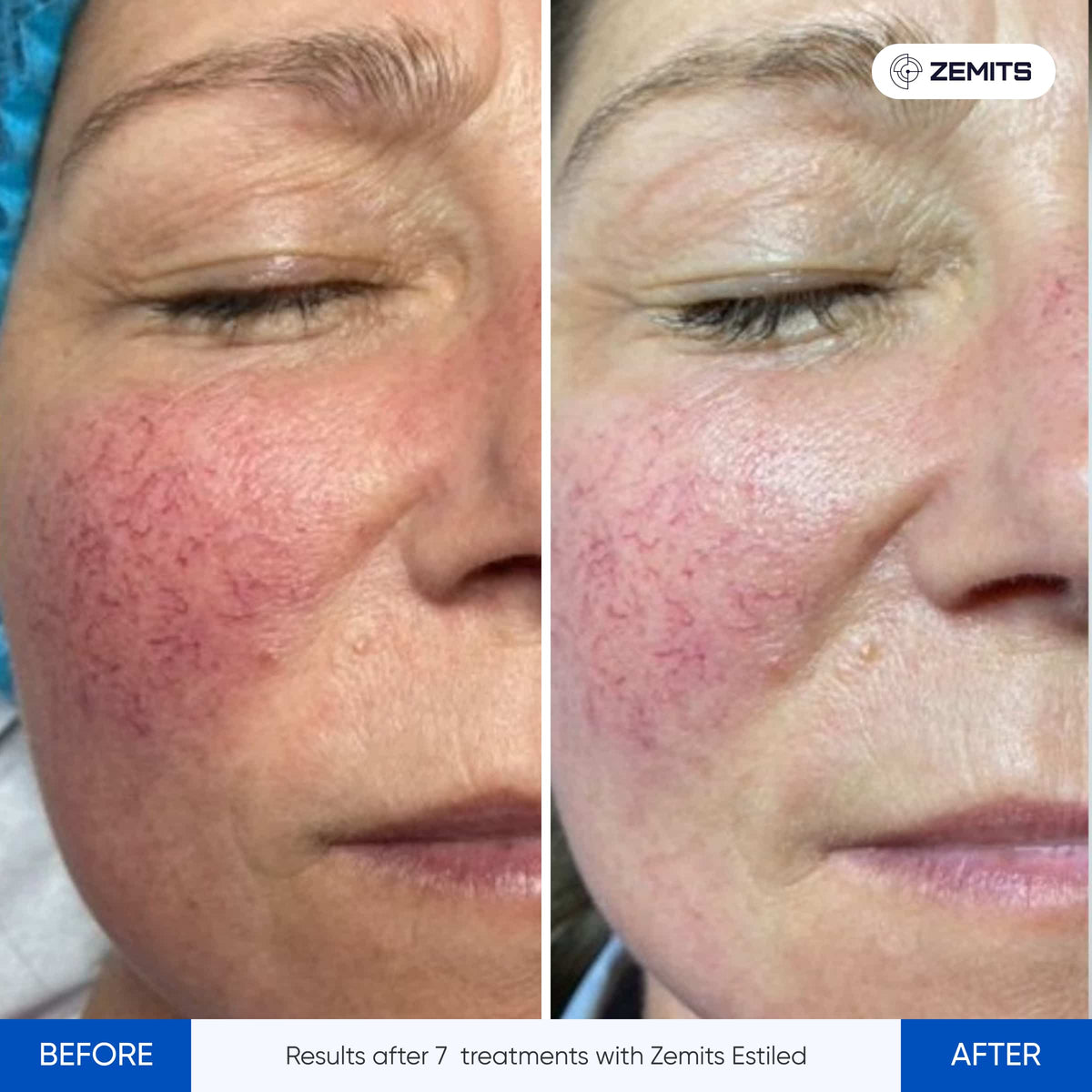Before After Slide 3