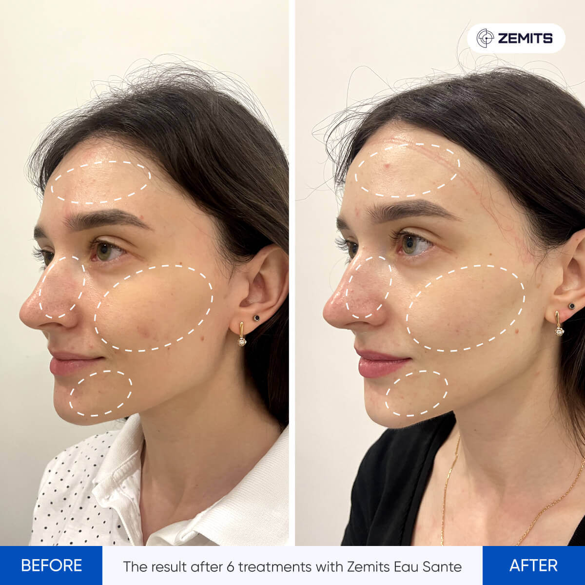 Before After Slide 5