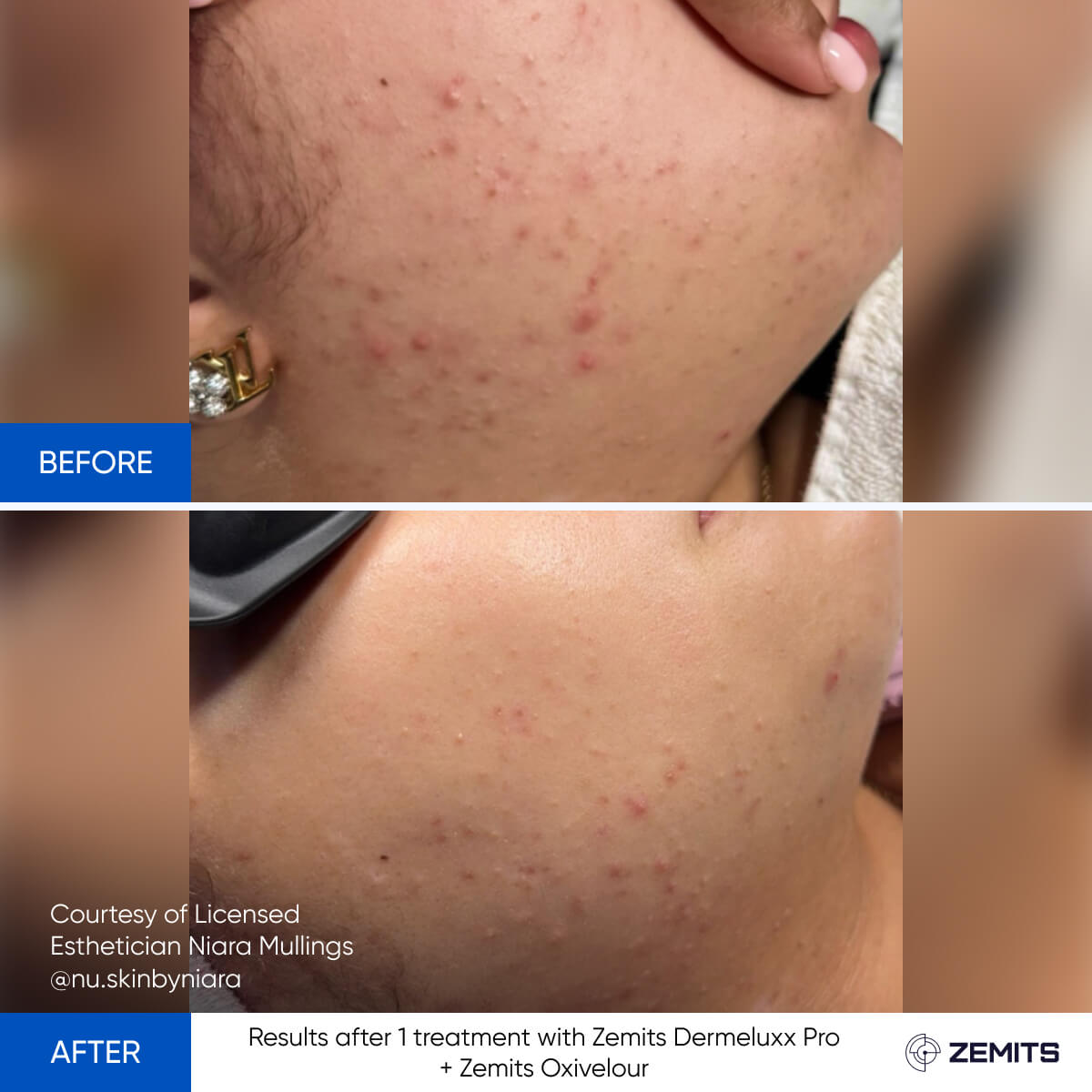 Before After Slide 6
