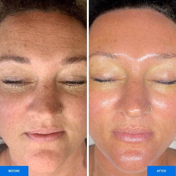 Before After Slide 2