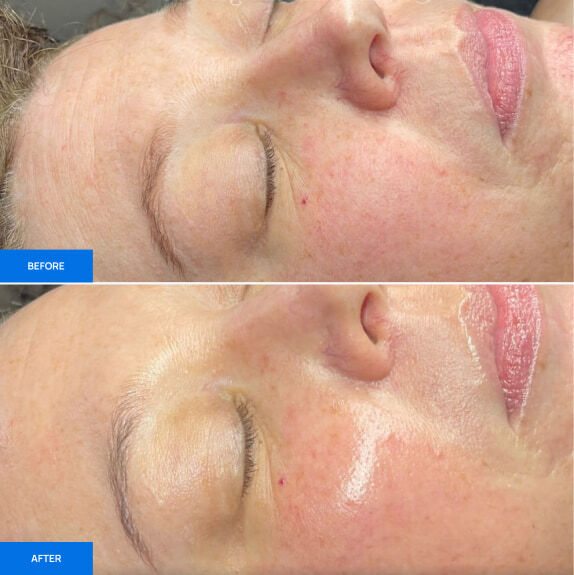 Before After Slide 3