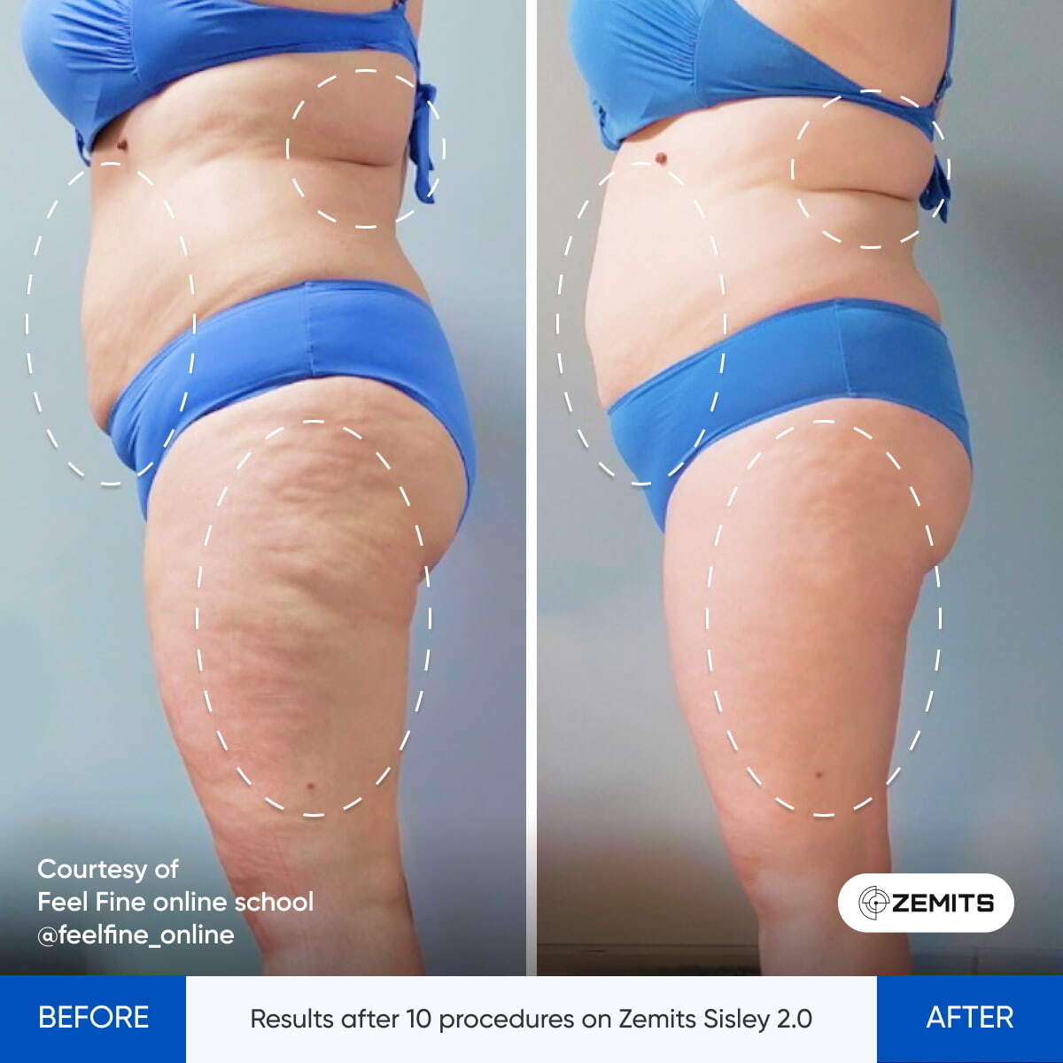 Before After Slide 4