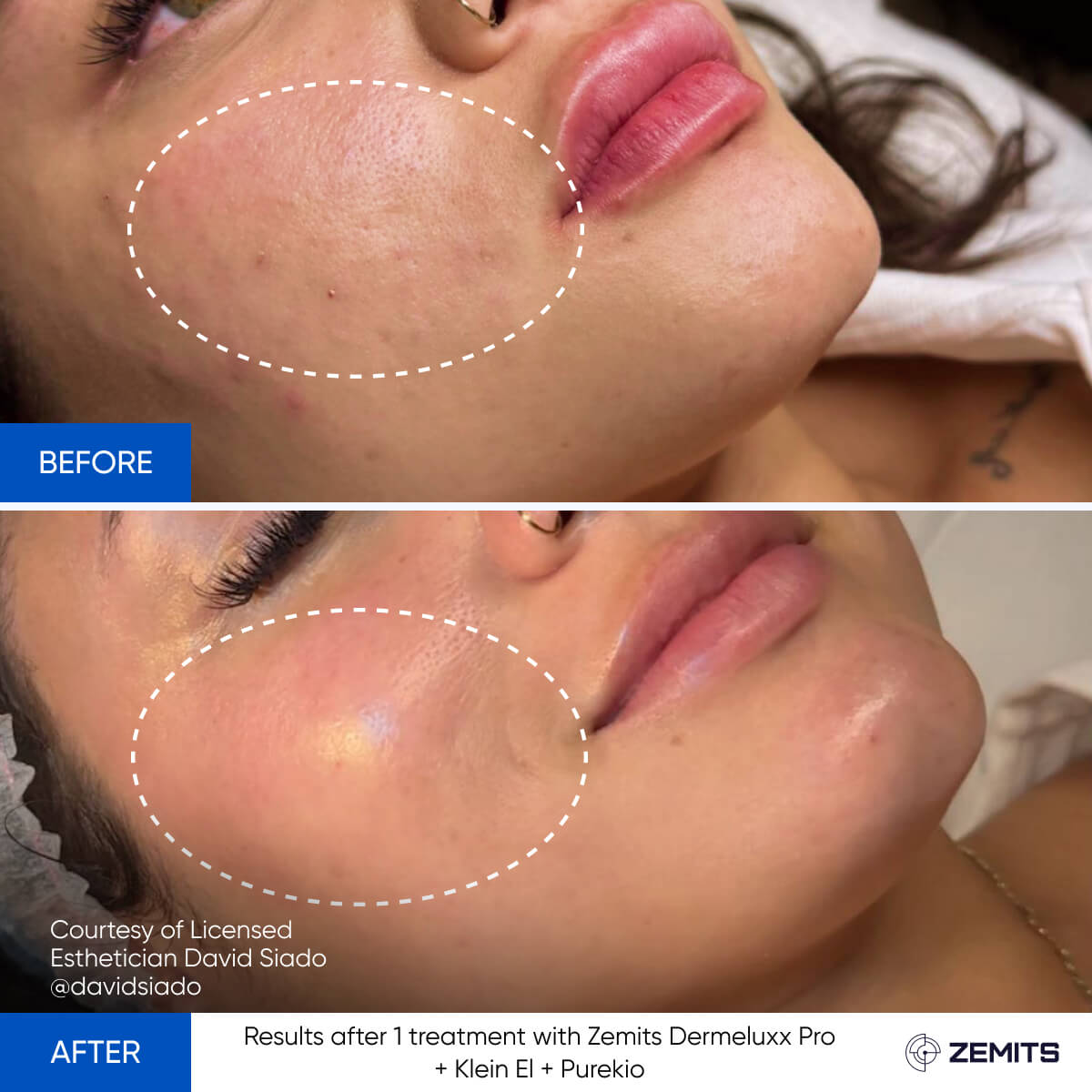 Before After Slide 16