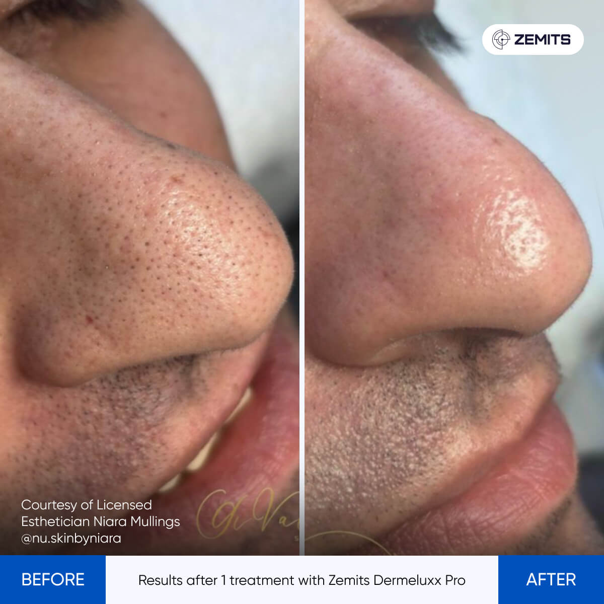 Before After Slide 21