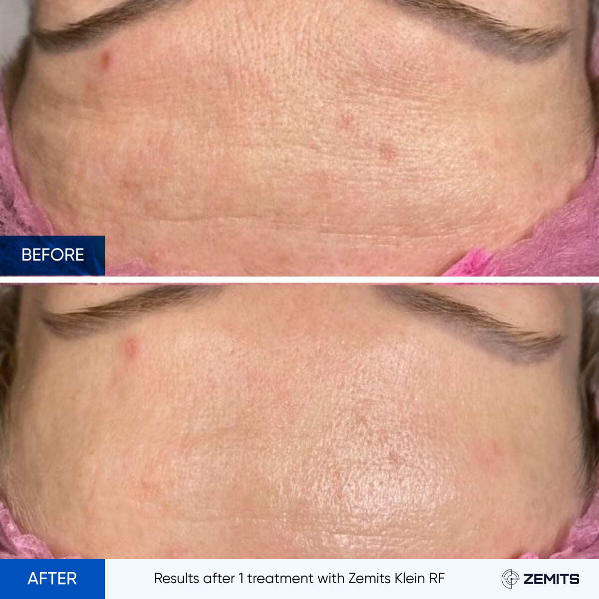 Before After Slide 16