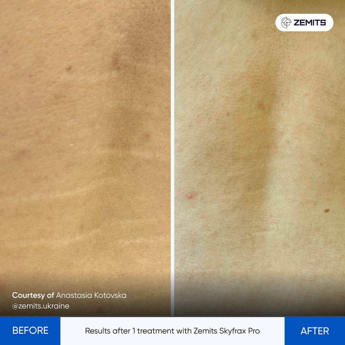 Before After Slide 3