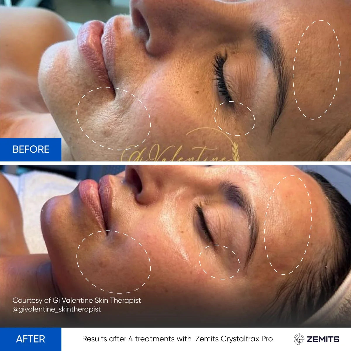 Before After Slide 5