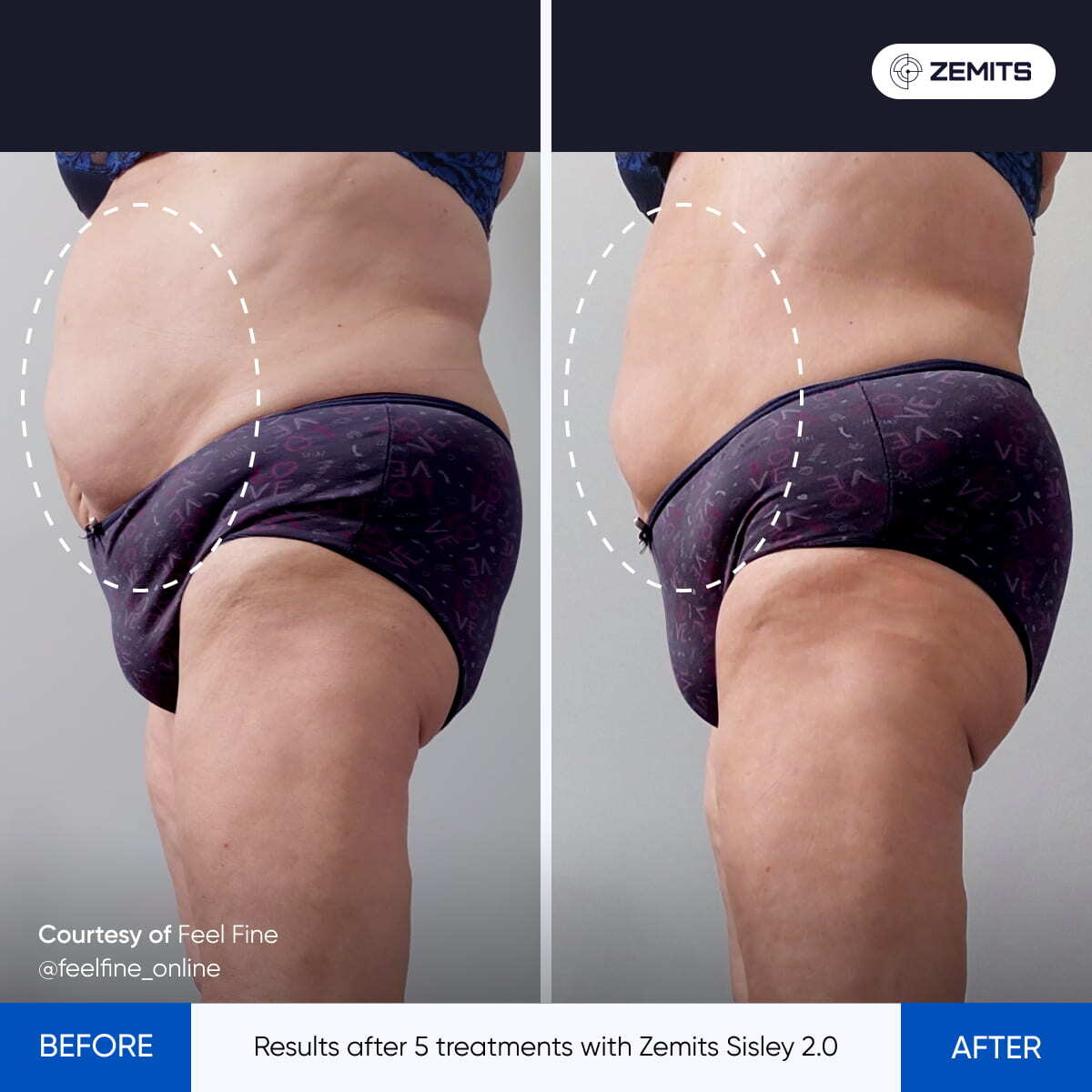 Before After Slide 3