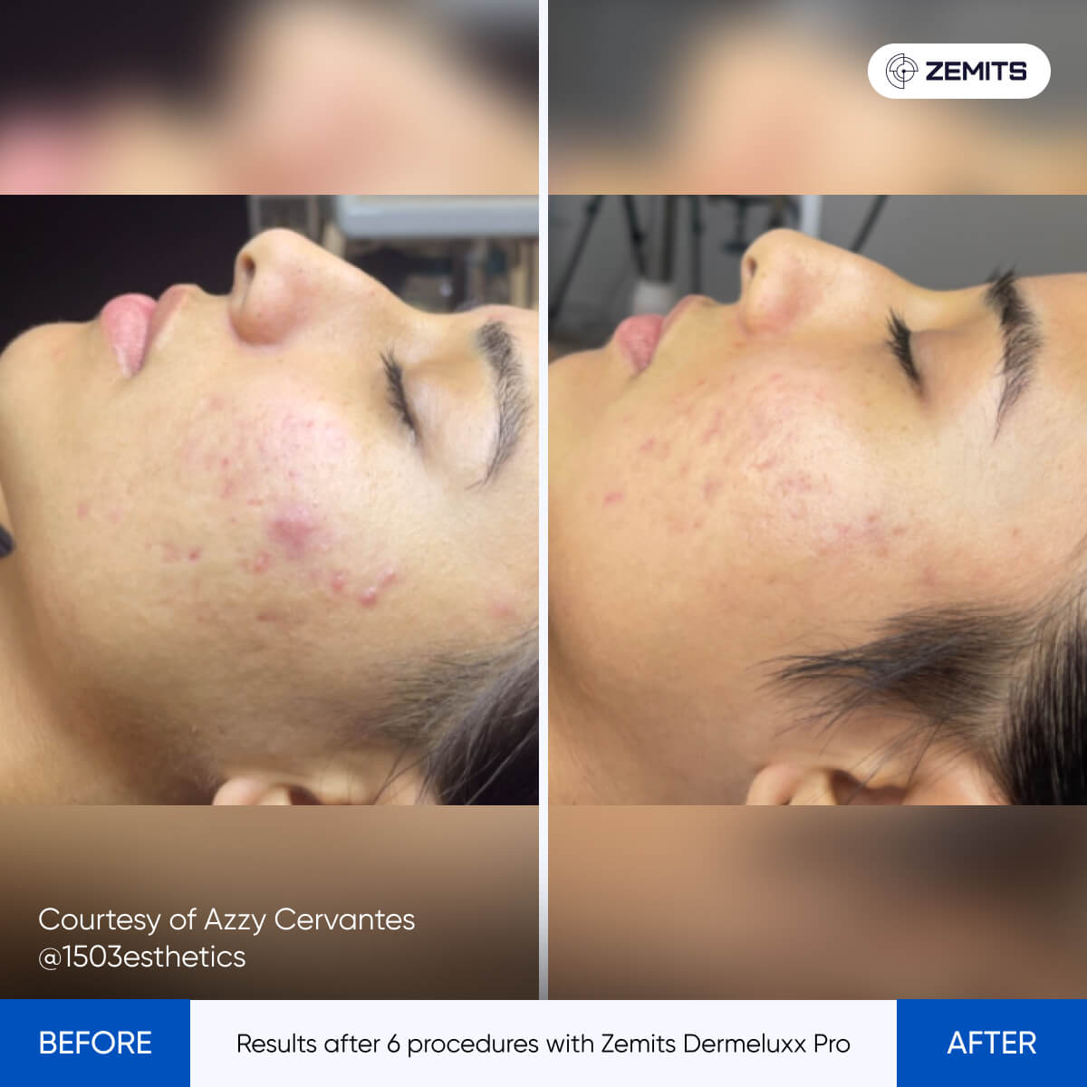 Before After Slide 8
