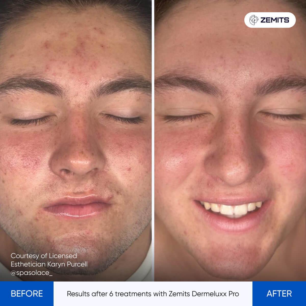 Before After Slide 17