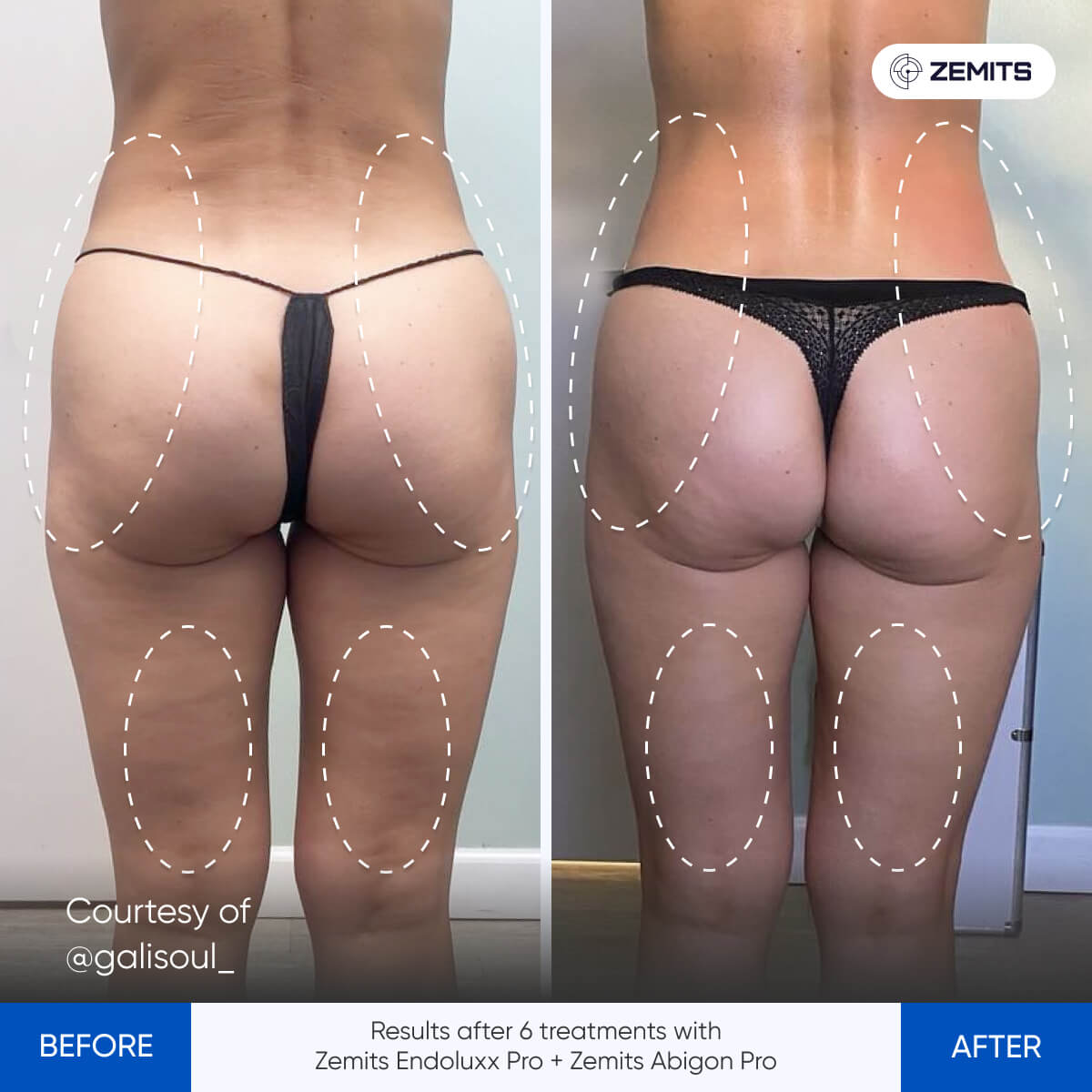 Before After Slide 6