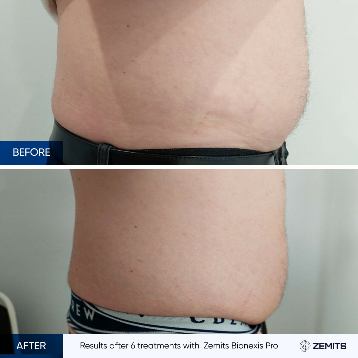 Before After Slide 8