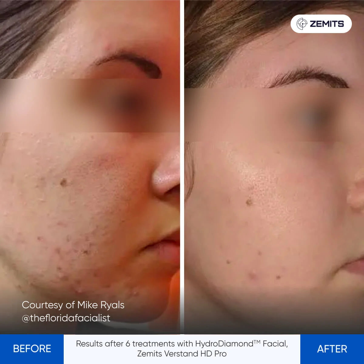 Before After Slide 3