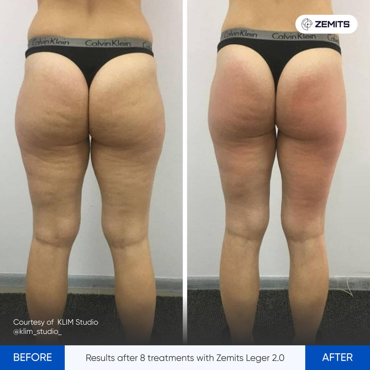 Before After Slide 5