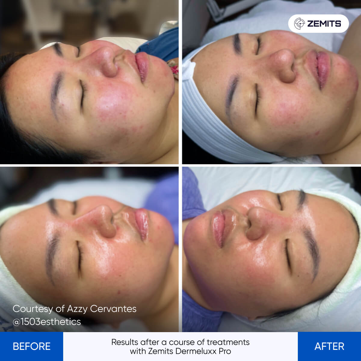 Before After Slide 10