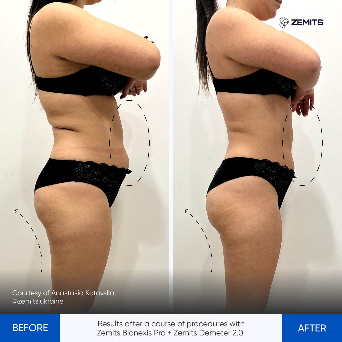 Before After Slide 15
