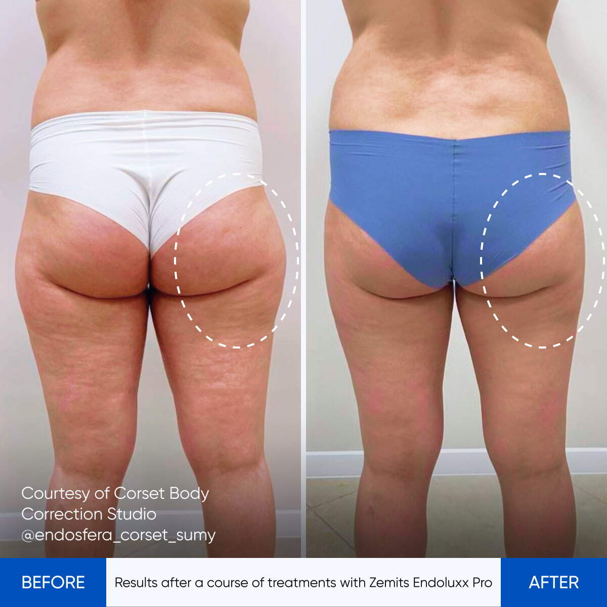 Before After Slide 5