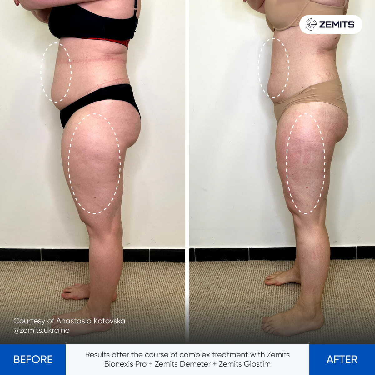 Before After Slide 10
