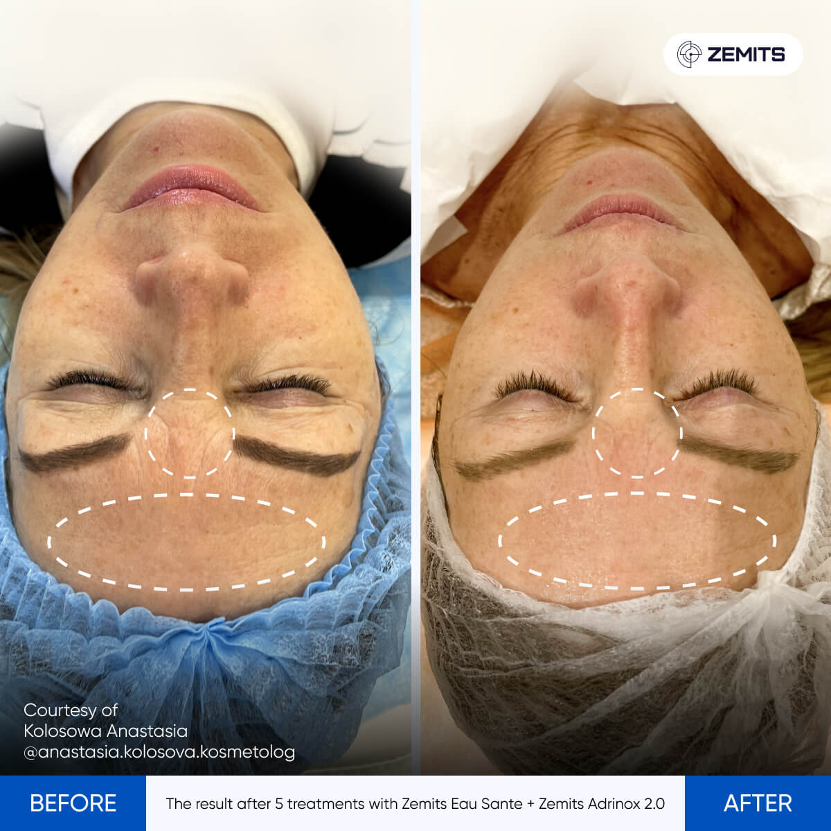 Before After Slide 4