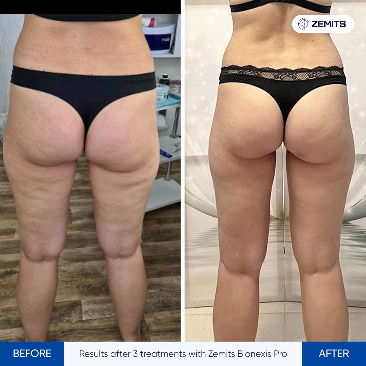 Before After Slide 4