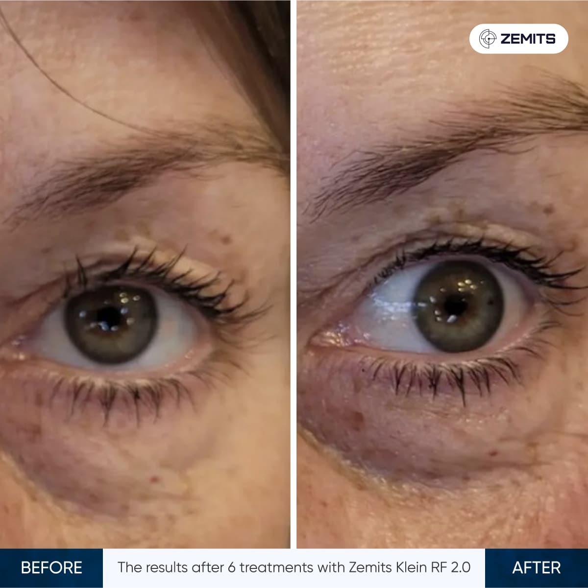 Before After Slide 5