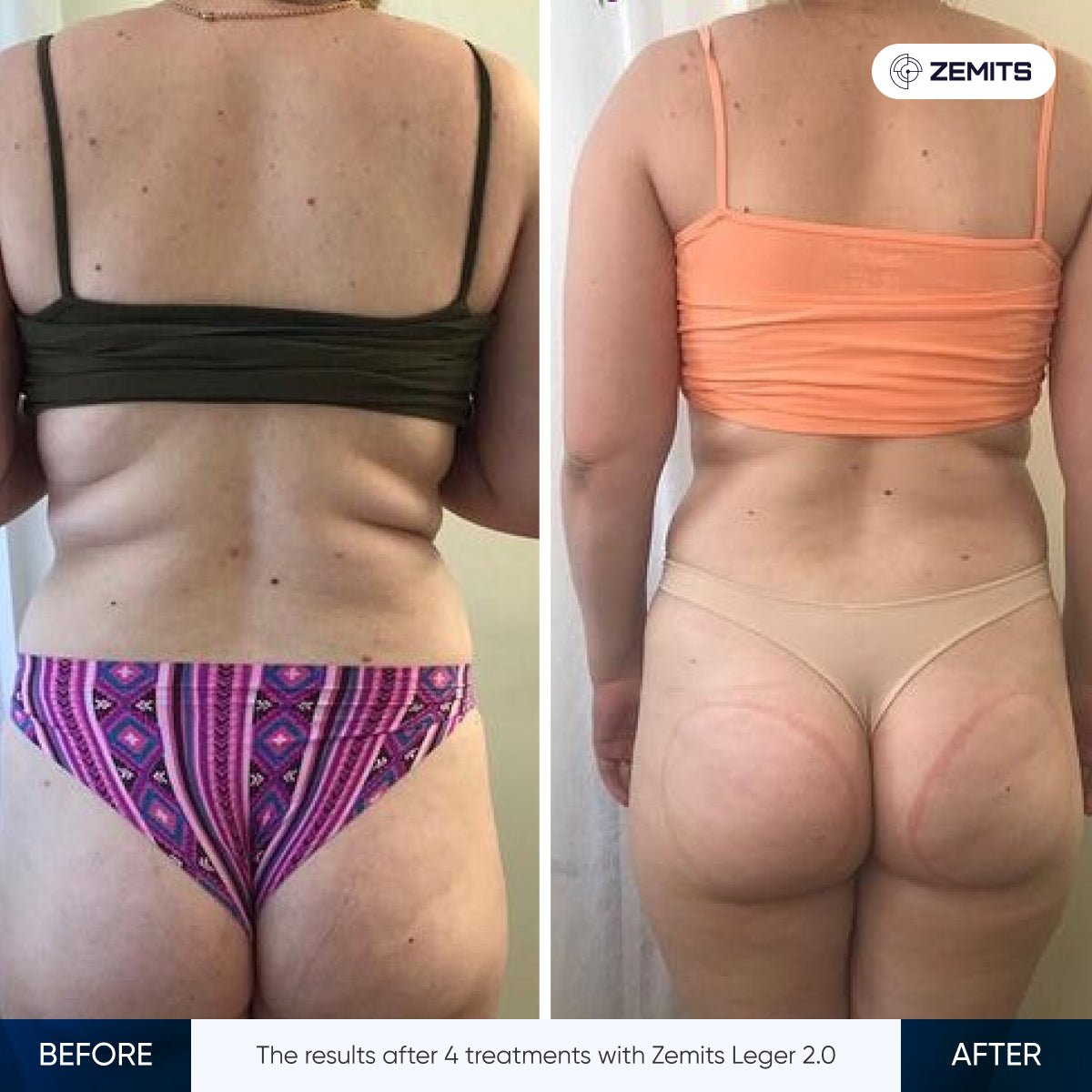 Before After Slide 8