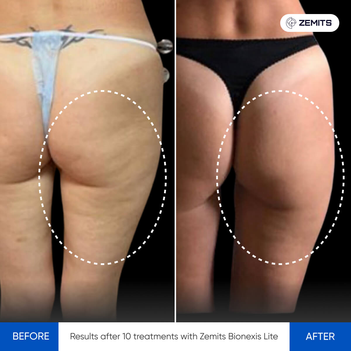 Before After Slide 2