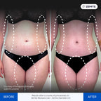 Before and after body sculpting results Zemits Bionexis Lite