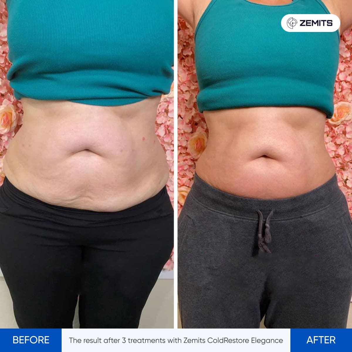 Before After Slide 3