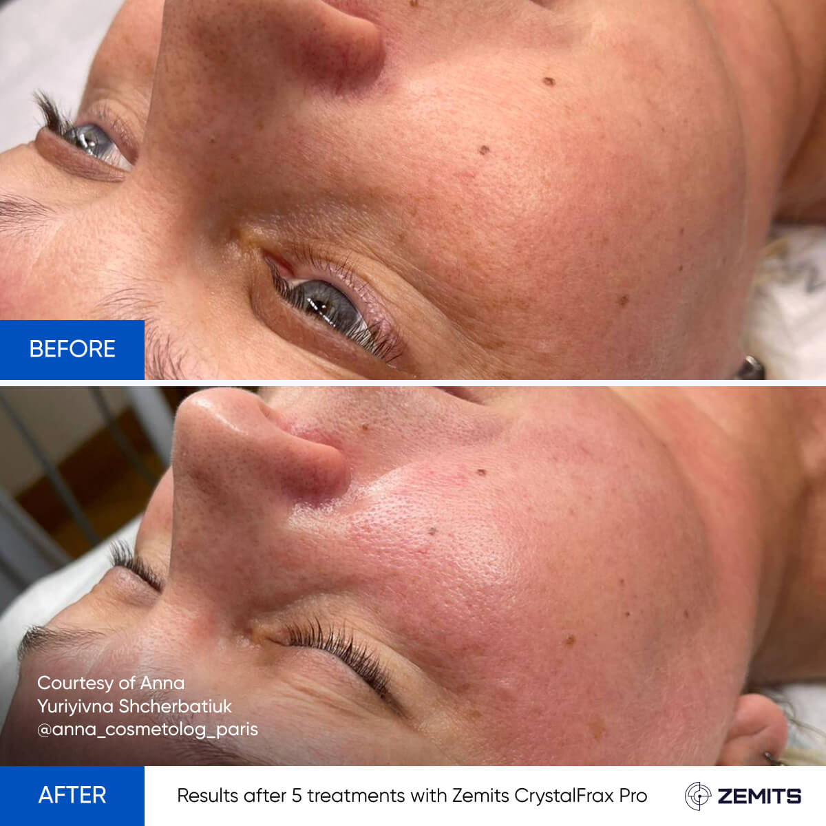Before After Slide 20