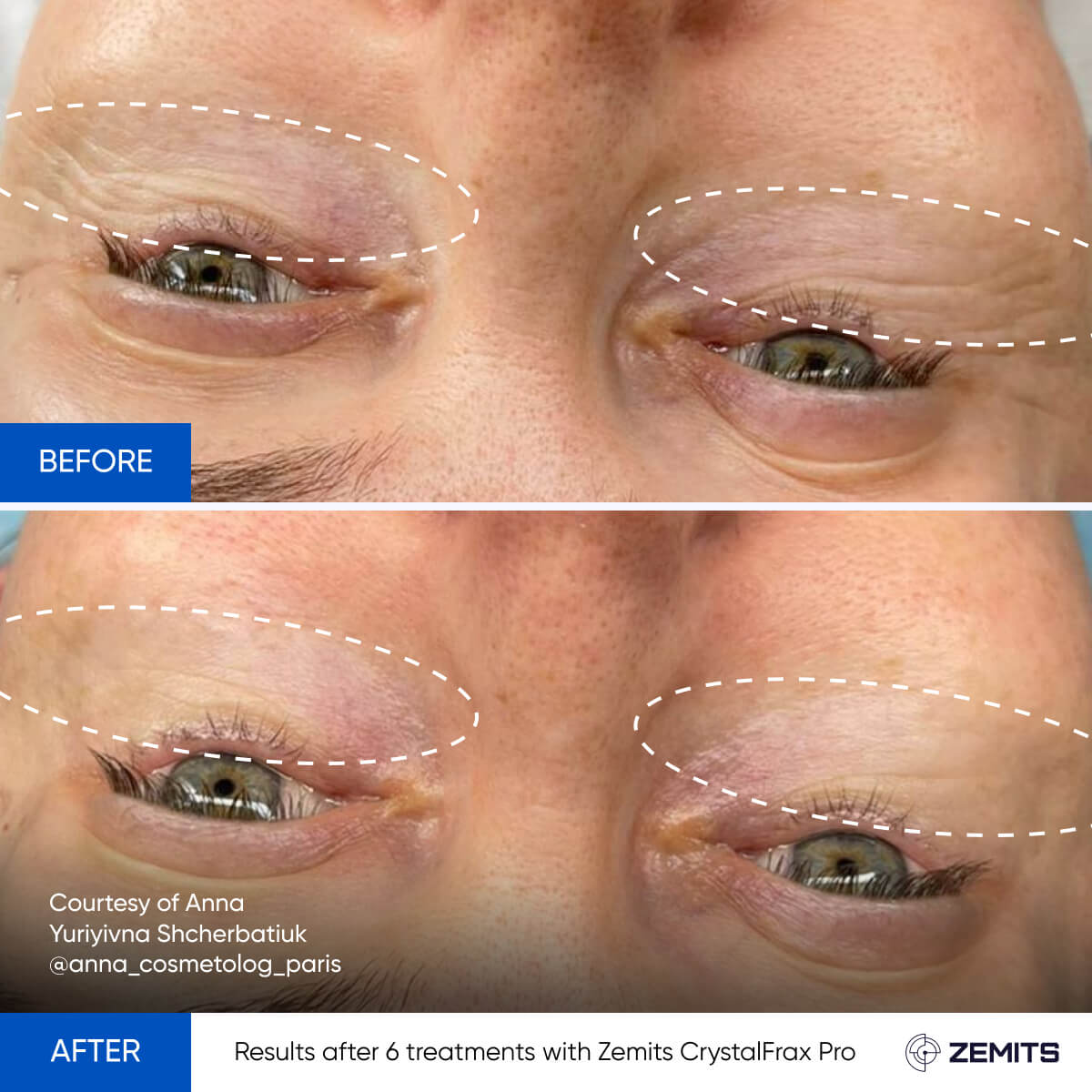 Before After Slide 21