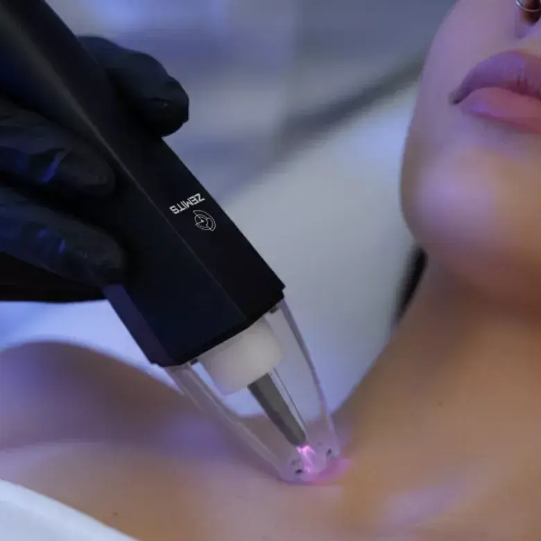 Cold Plasma Treatment with Zemits EvoPlasm