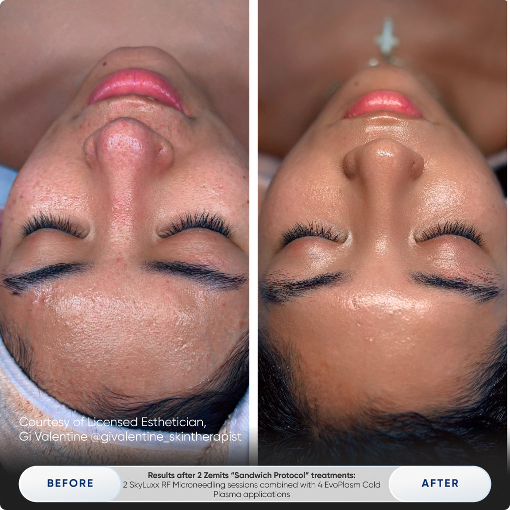 Before After Slide 6