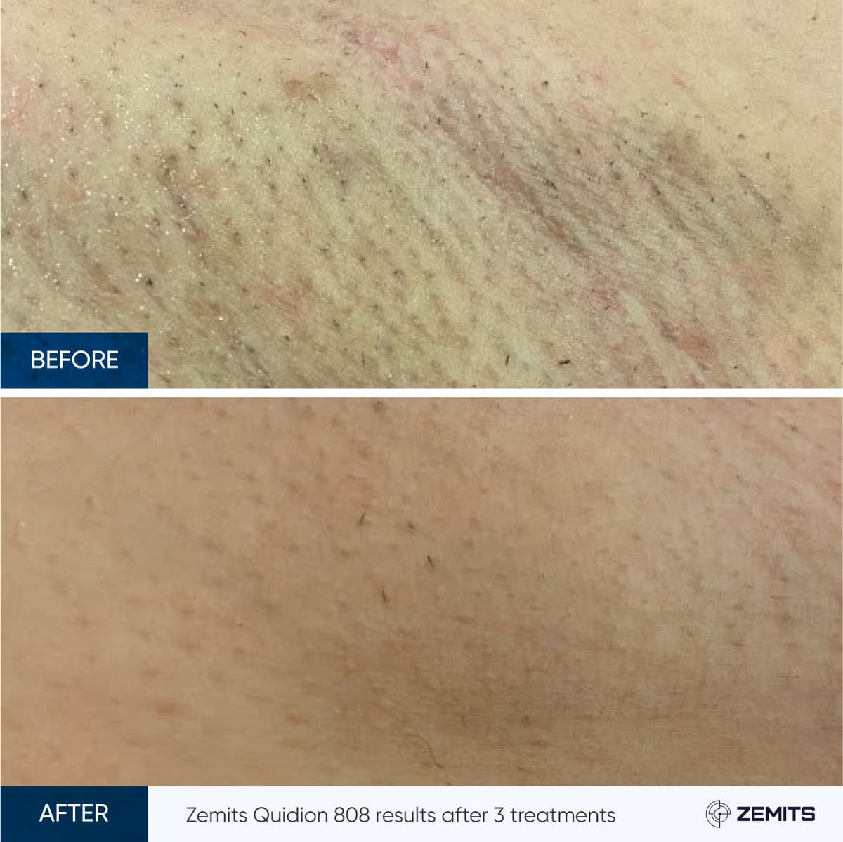 Before After Slide 1