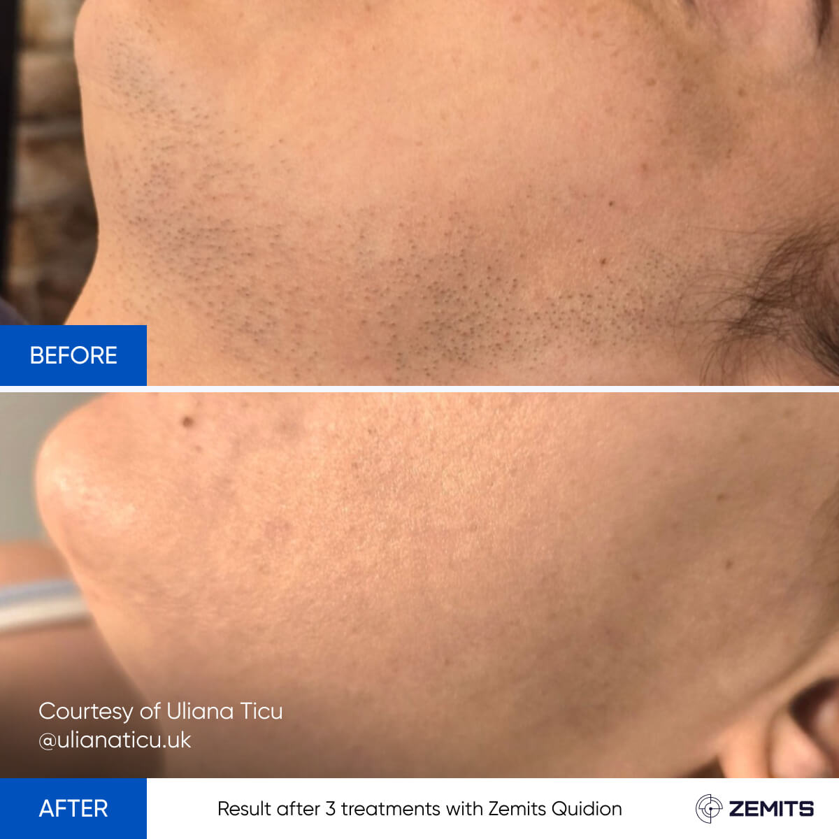 Before After Slide 3