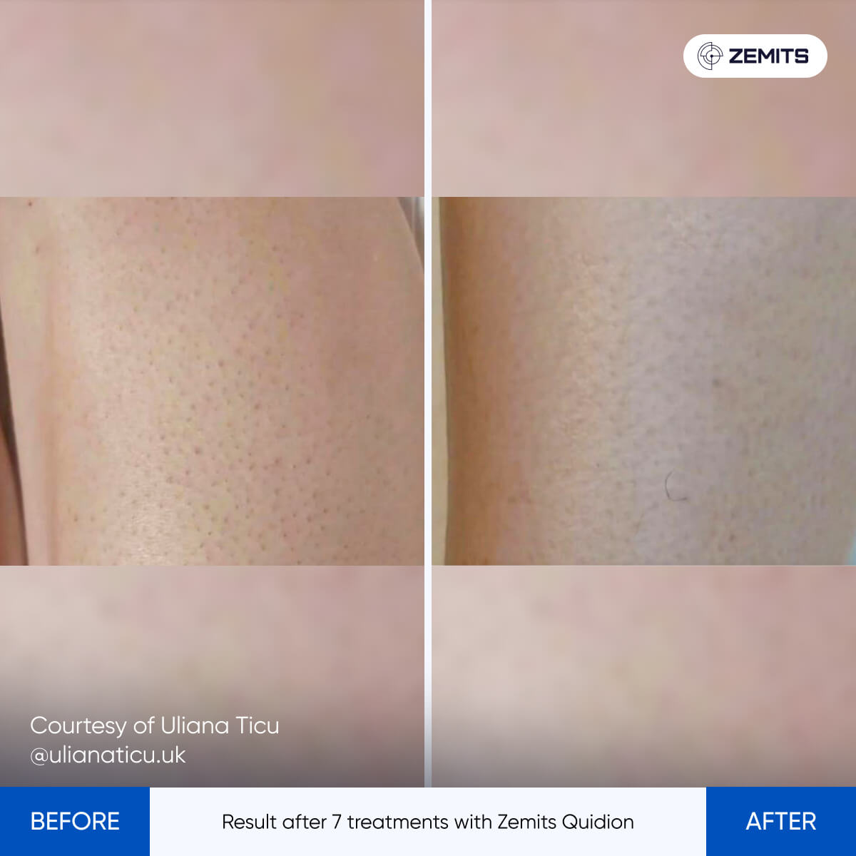 Before After Slide 5