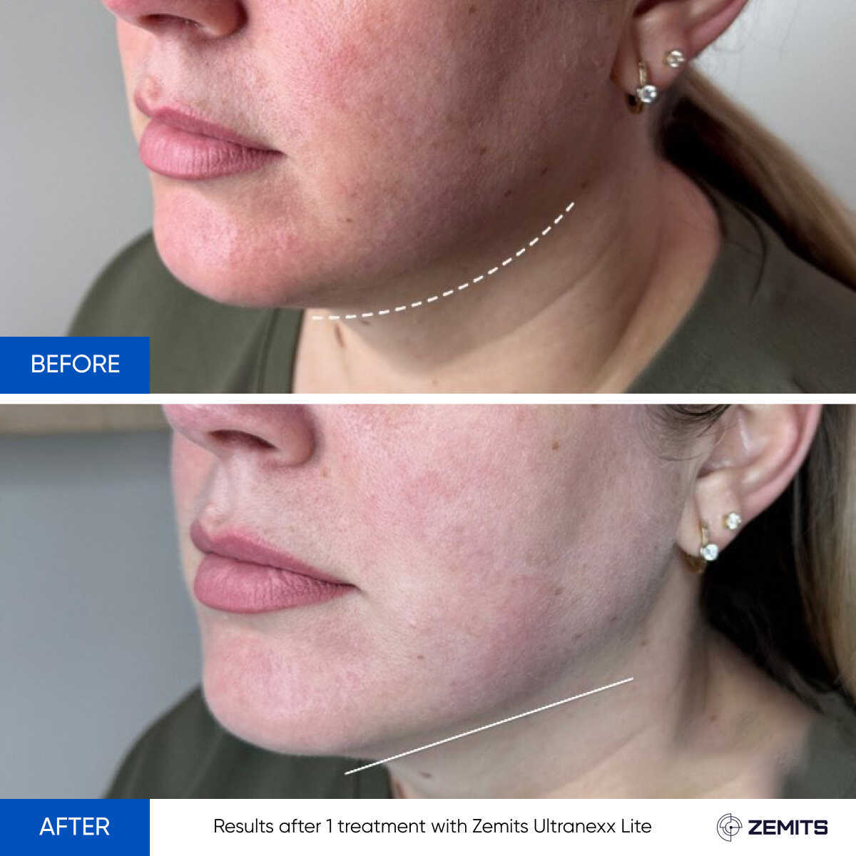 Before After Slide 6